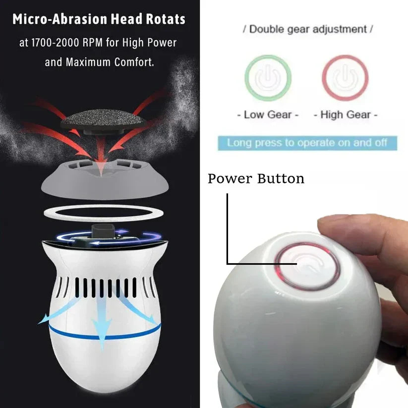 Electric Vacuum Foot Grinder